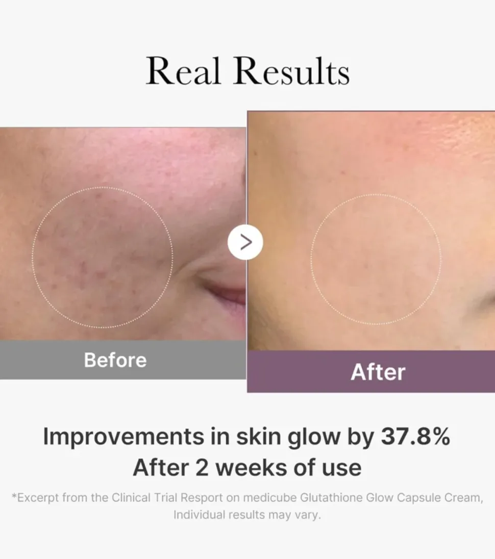 *Age-R* - Crema iluminadora Glutathione Glow Capsule