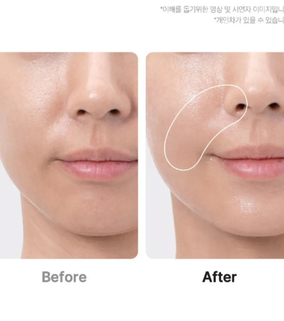 *Age-R* - Dispositivo avanzado de cuidado facial Booster Pro Ex