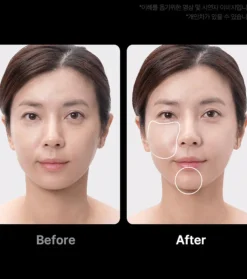 *Age-R* - Dispositivo avanzado de cuidado facial Booster Pro Ex