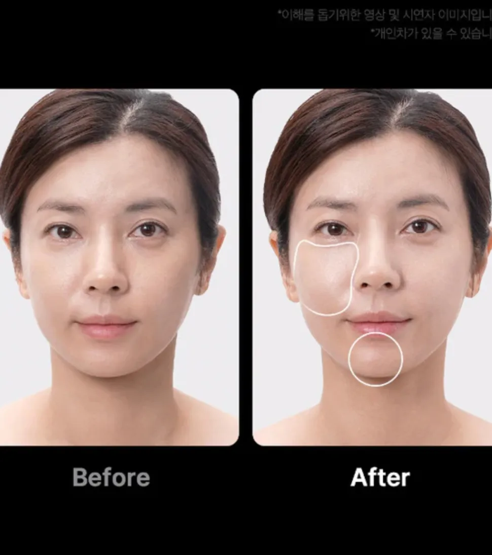 *Age-R* - Dispositivo avanzado de cuidado facial Booster Pro Ex