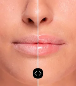 Brillo de labios voluminizador Hyaluronic Lip Volumiser