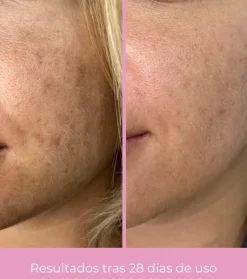 *Clarifying* - Crema facial despigmentante