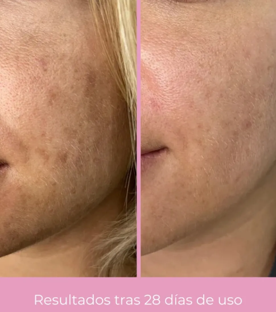 *Clarifying* - Crema facial despigmentante