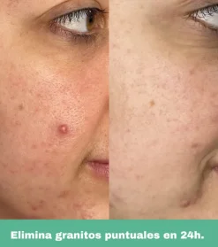 CR Cosmetics - *Purifying* - Roll on anti-imperfecciones