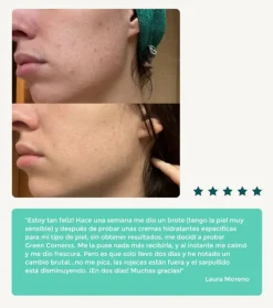 Crema facial hidratante de repollo - Pieles atópicas