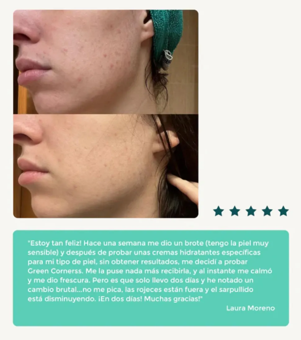 Crema facial hidratante de repollo - Pieles atópicas