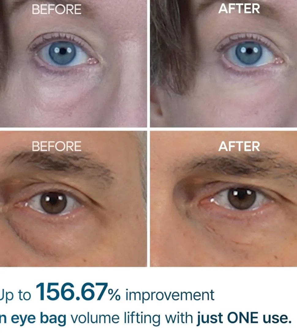 Crema para las ojeras Eyephalt