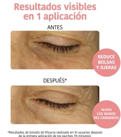 Parches anti-fatiga e iluminadores - Vitamina c, pepino y ácido hialurónico