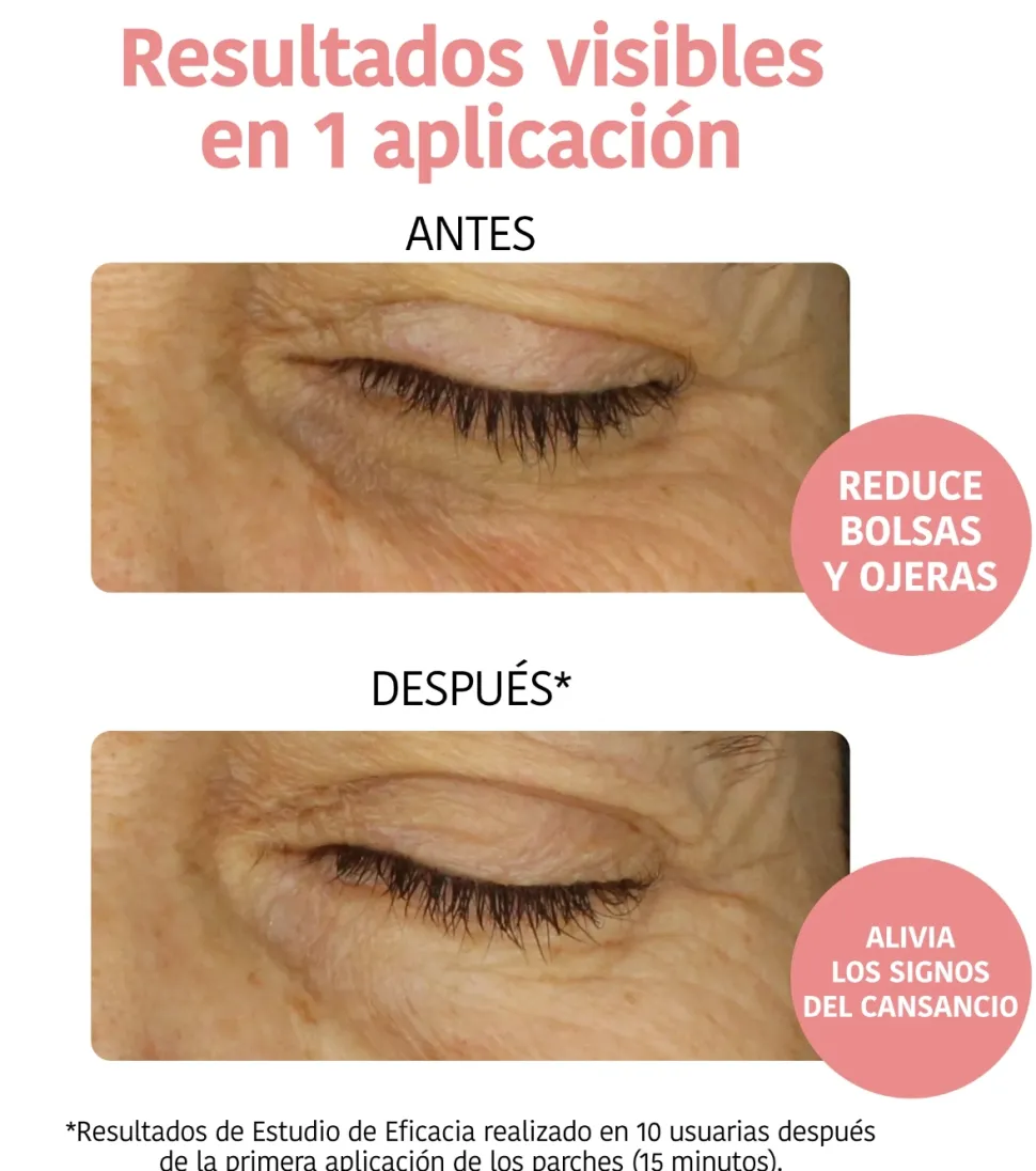 Parches anti-fatiga e iluminadores - Vitamina c, pepino y ácido hialurónico