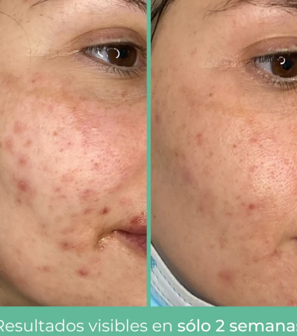 *Purifying* - Crema facial seborreguladora