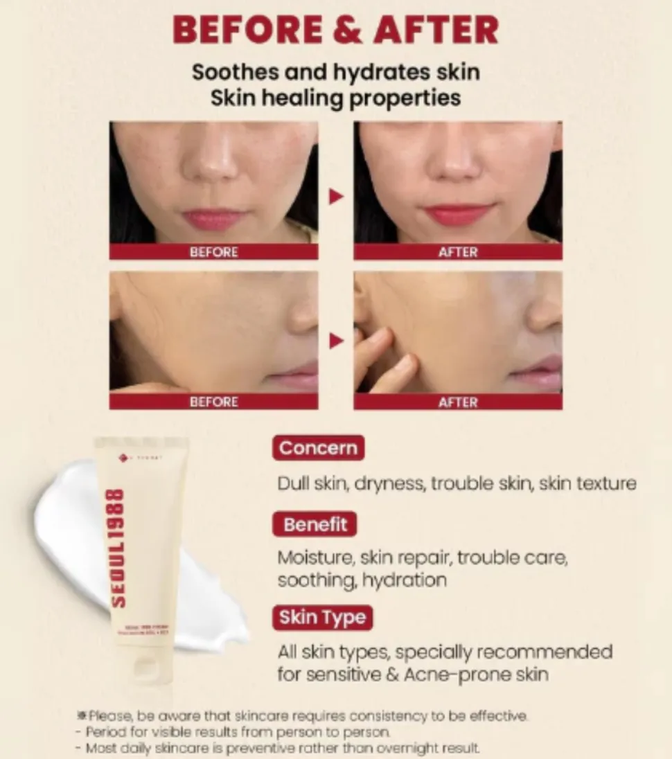 *Seoul 1988* - Crema facial Snail Mucin 93% + Rice
