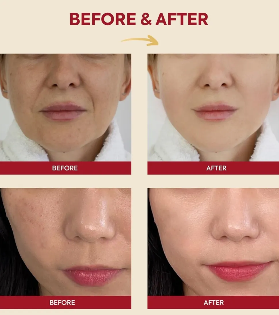 *Seoul 1988* - Esencia Snail Mucin 97% + Rice