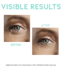 Sérum para el contorno de los ojos antiarrugas Wrinkle Lift