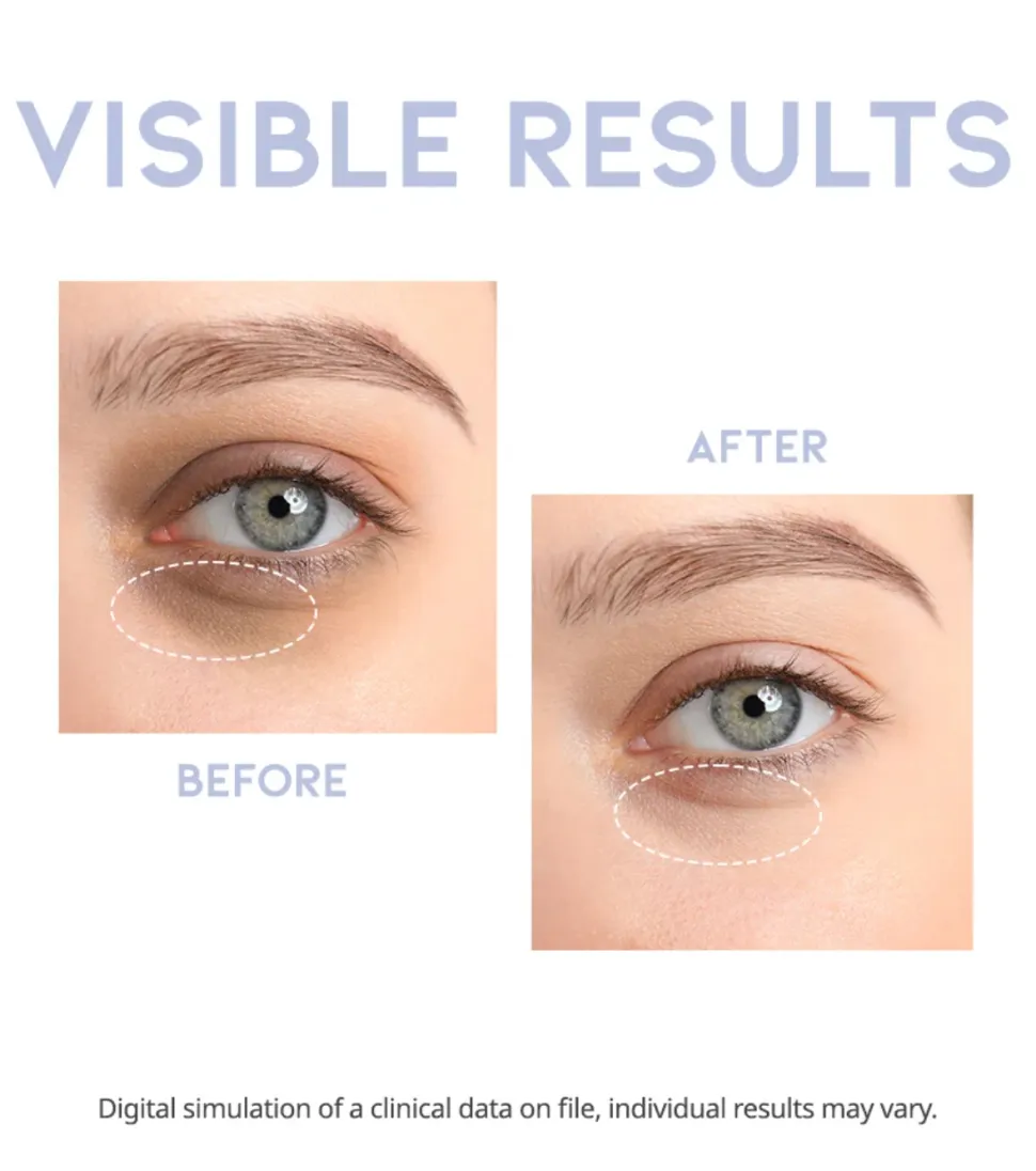 Sérum para el contorno de los ojos revitalizante Intensive Serum