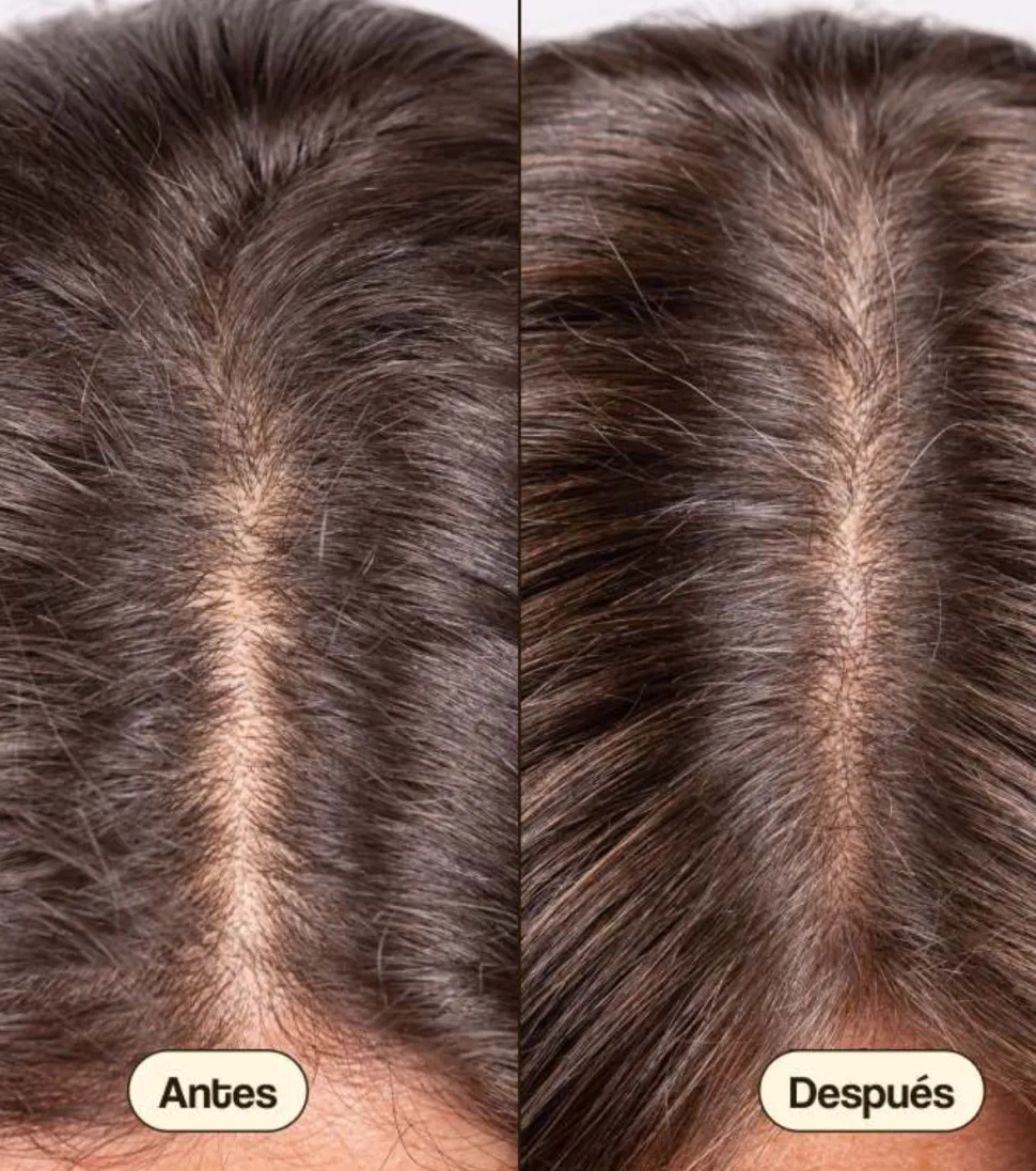 Tratamiento anticaída para el cabello Hair Growth & Density
