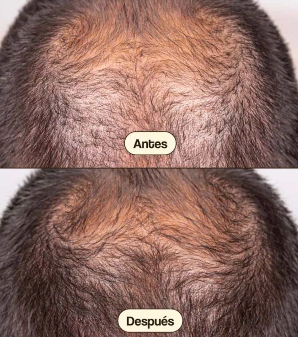 Tratamiento anticaída para el cabello Hair Growth & Density