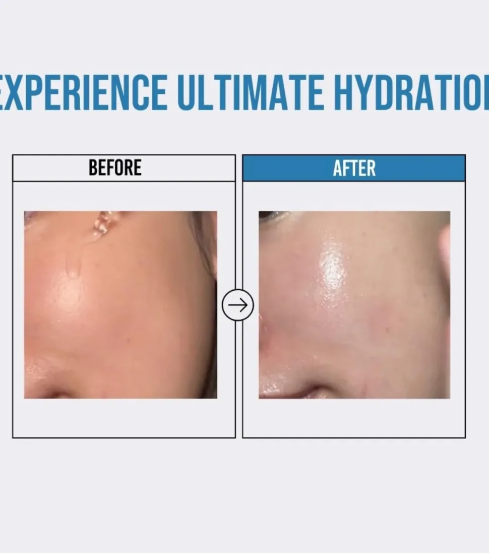 *Waterfull* - Sérum facial hidratante Hyaluronic Acid