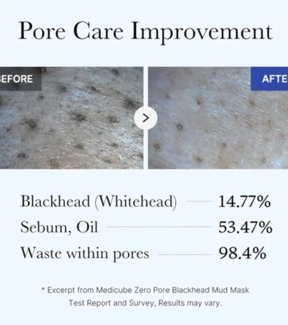 *Zero Pore* - Mascarilla con AHA, BHA y PHA Blackhead Mud Mask